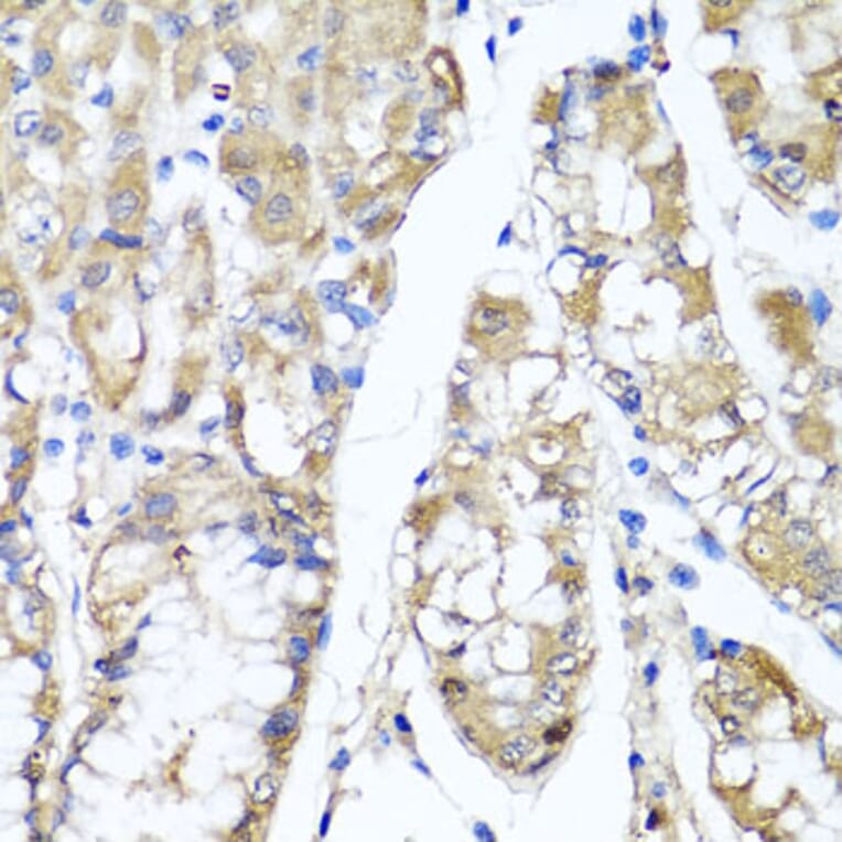 Anti-TNFAIP6 Antibody from Bioworld Technology (BS6310) - Antibodies.com