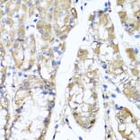 Anti-TNFAIP6 Antibody from Bioworld Technology (BS6310) - Antibodies.com
