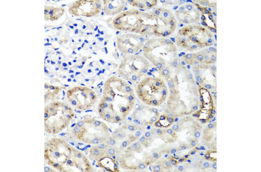Anti-TNFAIP6 Antibody from Bioworld Technology (BS6310) - Antibodies.com