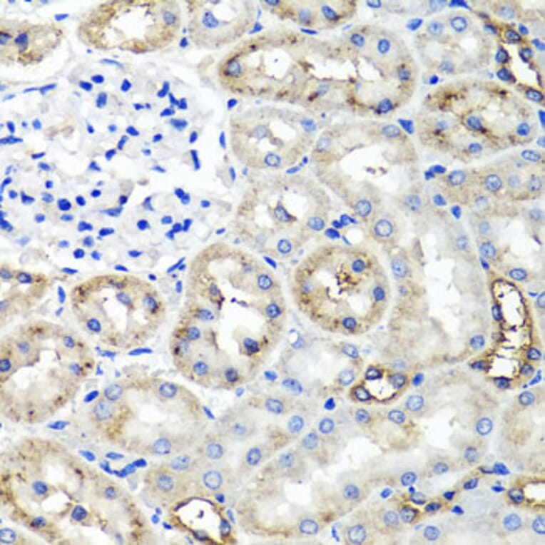 Anti-TNFAIP6 Antibody from Bioworld Technology (BS6310) - Antibodies.com