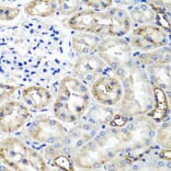 Anti-TNFAIP6 Antibody from Bioworld Technology (BS6310) - Antibodies.com