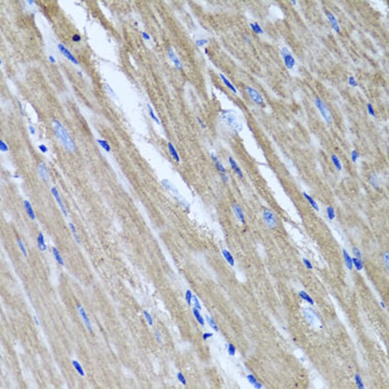 Anti-TNFAIP6 Antibody from Bioworld Technology (BS6310) - Antibodies.com