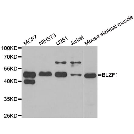 Anti-BLZF1 Antibody from Bioworld Technology (BS6311) - Antibodies.com