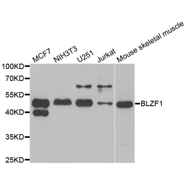 Anti-BLZF1 Antibody from Bioworld Technology (BS6311) - Antibodies.com