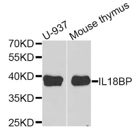 Anti-IL18BP Antibody from Bioworld Technology (BS6312) - Antibodies.com