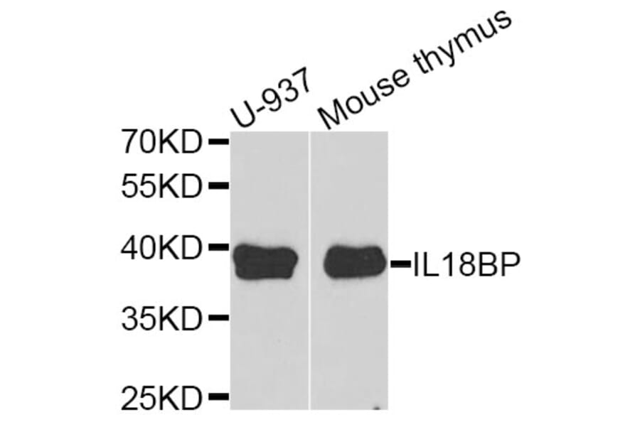 Anti-IL18BP Antibody from Bioworld Technology (BS6312) - Antibodies.com