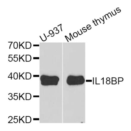 Anti-IL18BP Antibody from Bioworld Technology (BS6312) - Antibodies.com