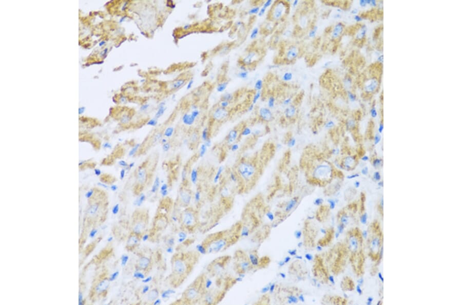 Anti-IL18BP Antibody from Bioworld Technology (BS6312) - Antibodies.com