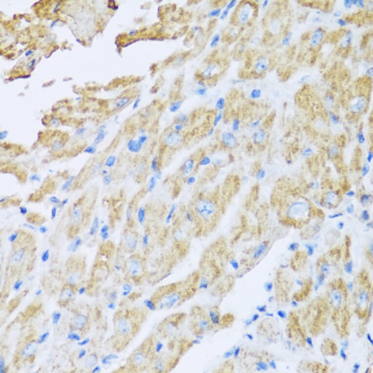 Anti-IL18BP Antibody from Bioworld Technology (BS6312) - Antibodies.com