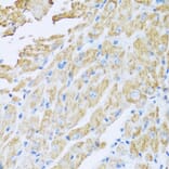 Anti-IL18BP Antibody from Bioworld Technology (BS6312) - Antibodies.com