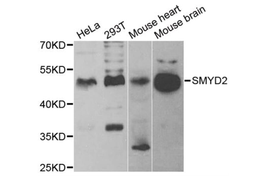 Anti-SMYD2 Antibody from Bioworld Technology (BS6313) - Antibodies.com