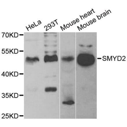 Anti-SMYD2 Antibody from Bioworld Technology (BS6313) - Antibodies.com