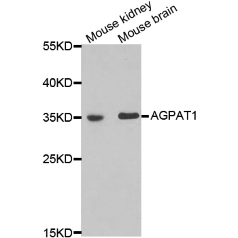 Anti-AGPAT1 Antibody from Bioworld Technology (BS6317) - Antibodies.com