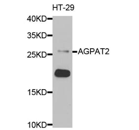 Anti-AGPAT2 Antibody from Bioworld Technology (BS6318) - Antibodies.com
