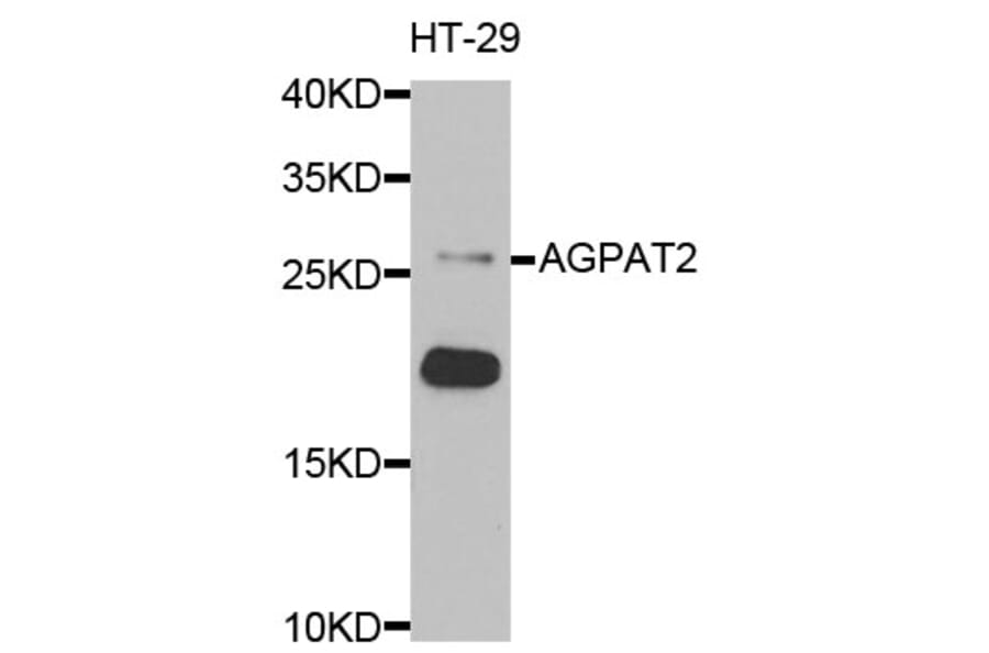 Anti-AGPAT2 Antibody from Bioworld Technology (BS6318) - Antibodies.com