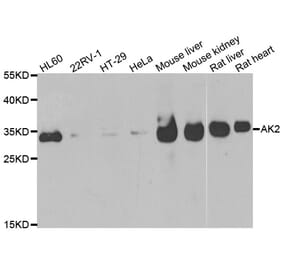 Anti-AK2 Antibody from Bioworld Technology (BS6319) - Antibodies.com