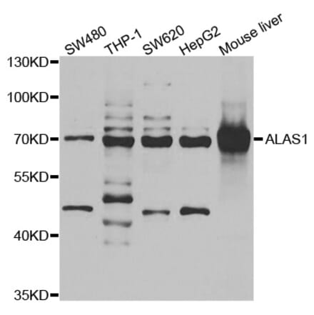 Anti-ALAS1 Antibody from Bioworld Technology (BS6320) - Antibodies.com