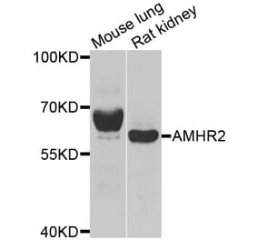 Anti-AMHR2 Antibody from Bioworld Technology (BS6322) - Antibodies.com