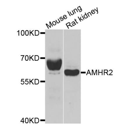 Anti-AMHR2 Antibody from Bioworld Technology (BS6322) - Antibodies.com