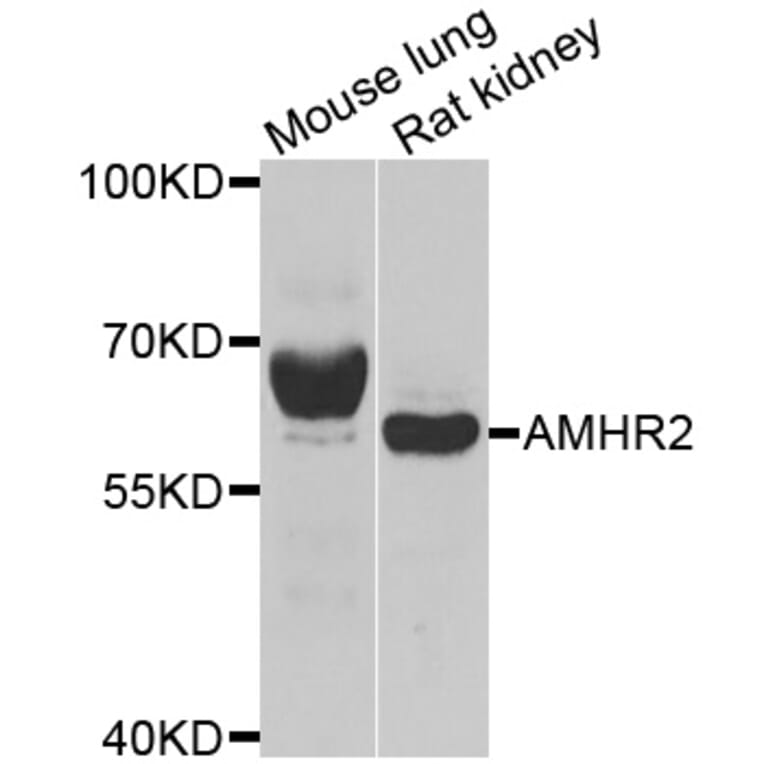 Anti-AMHR2 Antibody from Bioworld Technology (BS6322) - Antibodies.com