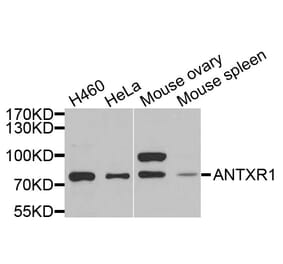 Anti-ANTXR2 Antibody from Bioworld Technology (BS6325) - Antibodies.com