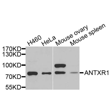 Anti-ANTXR2 Antibody from Bioworld Technology (BS6325) - Antibodies.com