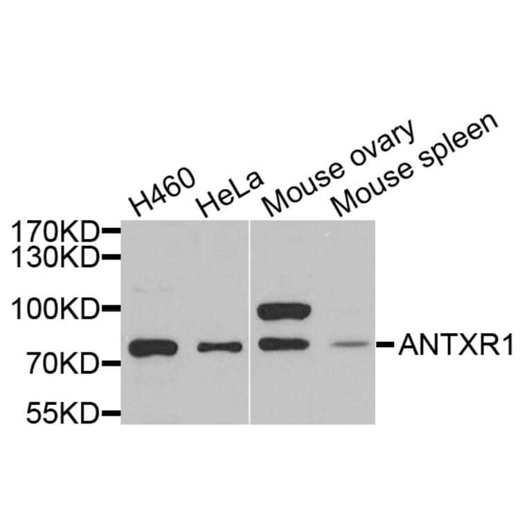 Anti-ANTXR2 Antibody from Bioworld Technology (BS6325) - Antibodies.com