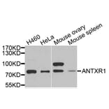 Anti-ANTXR2 Antibody from Bioworld Technology (BS6325) - Antibodies.com