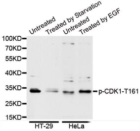 Anti-Cdk1/Cdc2 (phospho-T161) Antibody from Bioworld Technology (BS6340) - Antibodies.com