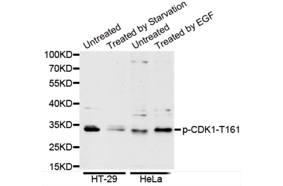 Anti-Cdk1/Cdc2 (phospho-T161) Antibody from Bioworld Technology (BS6340) - Antibodies.com