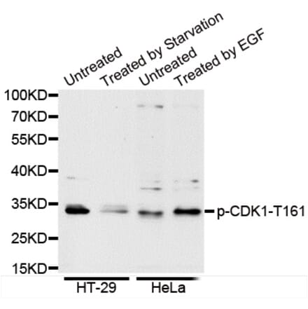 Anti-Cdk1/Cdc2 (phospho-T161) Antibody from Bioworld Technology (BS6340) - Antibodies.com