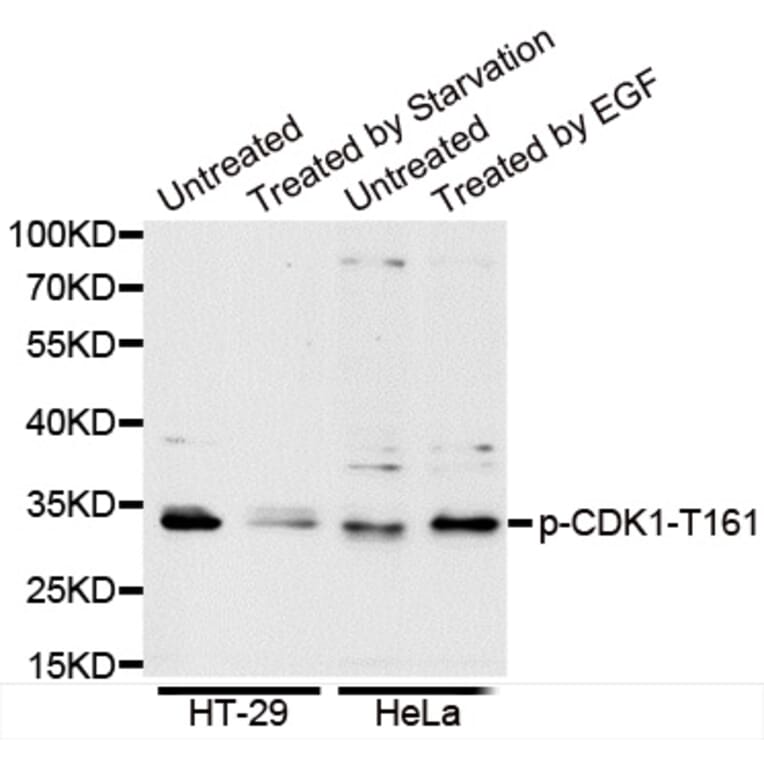 Anti-Cdk1/Cdc2 (phospho-T161) Antibody from Bioworld Technology (BS6340) - Antibodies.com