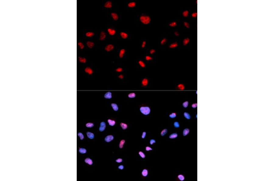 Anti-Cdk1/Cdc2 (phospho-T161) Antibody from Bioworld Technology (BS6340) - Antibodies.com