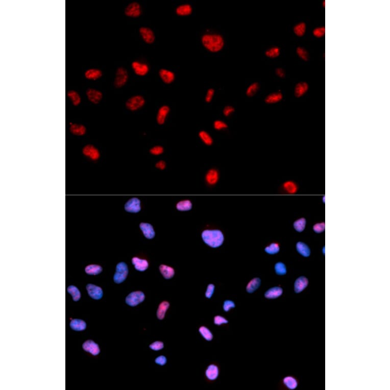 Anti-Cdk1/Cdc2 (phospho-T161) Antibody from Bioworld Technology (BS6340) - Antibodies.com