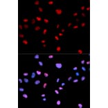 Anti-Cdk1/Cdc2 (phospho-T161) Antibody from Bioworld Technology (BS6340) - Antibodies.com