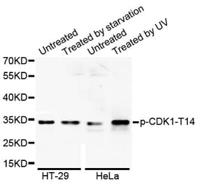 Anti-Cdk1/Cdc2 (phospho-T14) Antibody from Bioworld Technology (BS6341) - Antibodies.com
