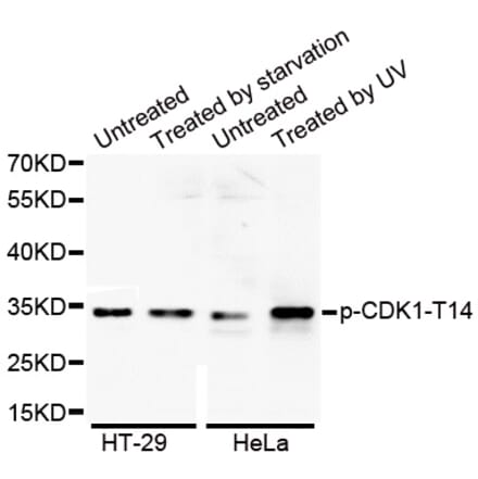 Anti-Cdk1/Cdc2 (phospho-T14) Antibody from Bioworld Technology (BS6341) - Antibodies.com