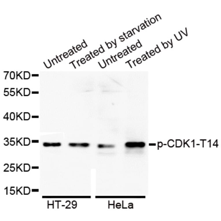 Anti-Cdk1/Cdc2 (phospho-T14) Antibody from Bioworld Technology (BS6341) - Antibodies.com