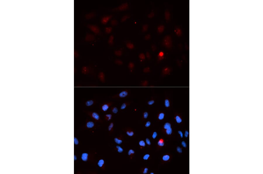Anti-Cdk1/Cdc2 (phospho-T14) Antibody from Bioworld Technology (BS6341) - Antibodies.com