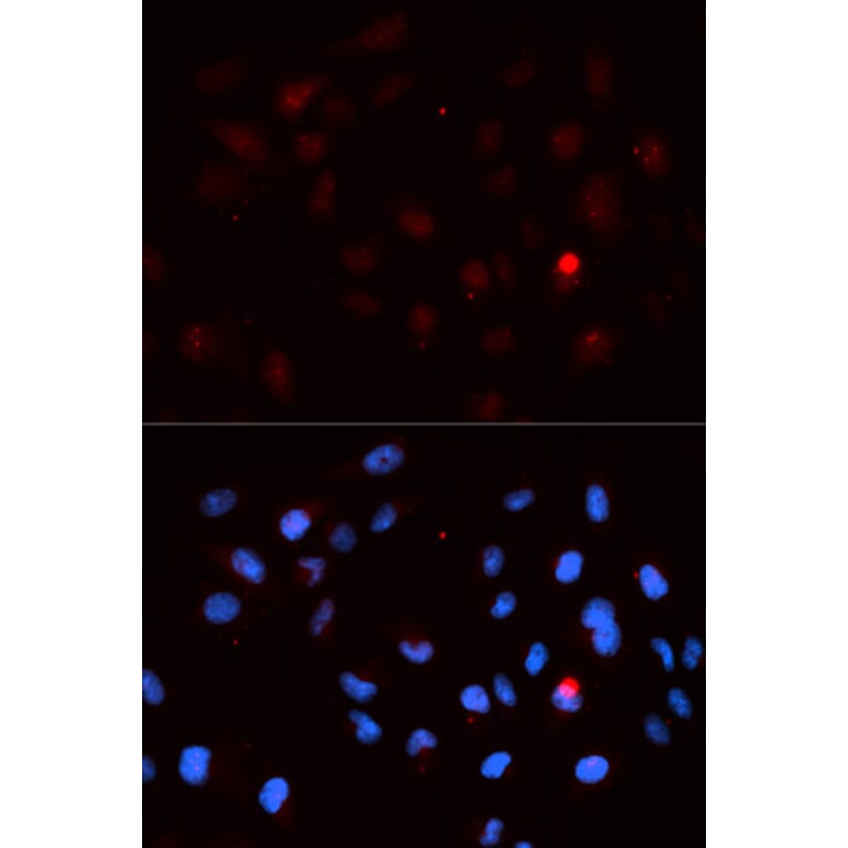 Anti-Cdk1/Cdc2 (phospho-T14) Antibody from Bioworld Technology (BS6341) - Antibodies.com