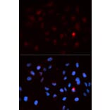 Anti-Cdk1/Cdc2 (phospho-T14) Antibody from Bioworld Technology (BS6341) - Antibodies.com