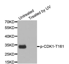 Anti-Cdk1/Cdc2 (phospho-Y15) Antibody from Bioworld Technology (BS6342) - Antibodies.com