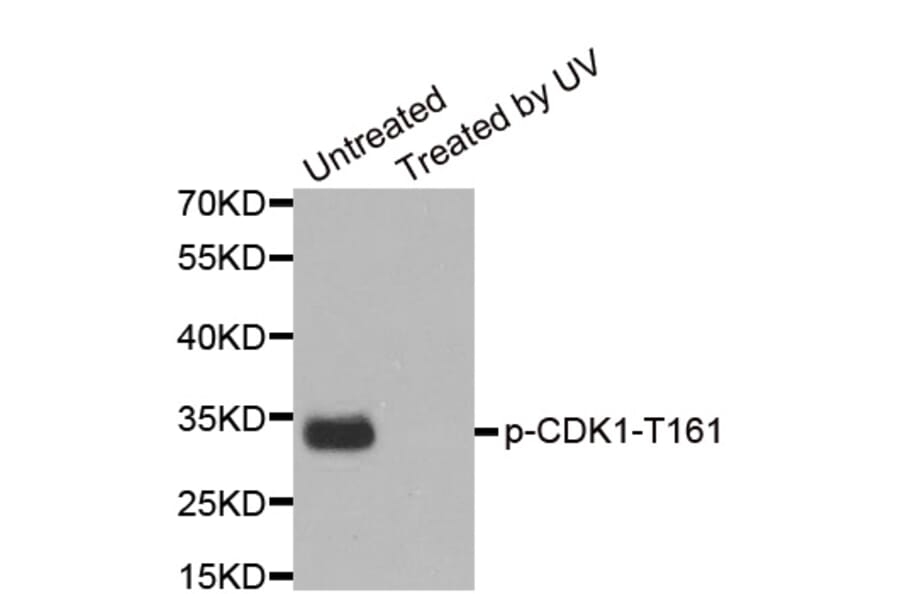 Anti-Cdk1/Cdc2 (phospho-Y15) Antibody from Bioworld Technology (BS6342) - Antibodies.com