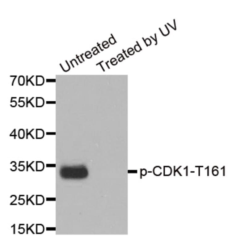 Anti-Cdk1/Cdc2 (phospho-Y15) Antibody from Bioworld Technology (BS6342) - Antibodies.com