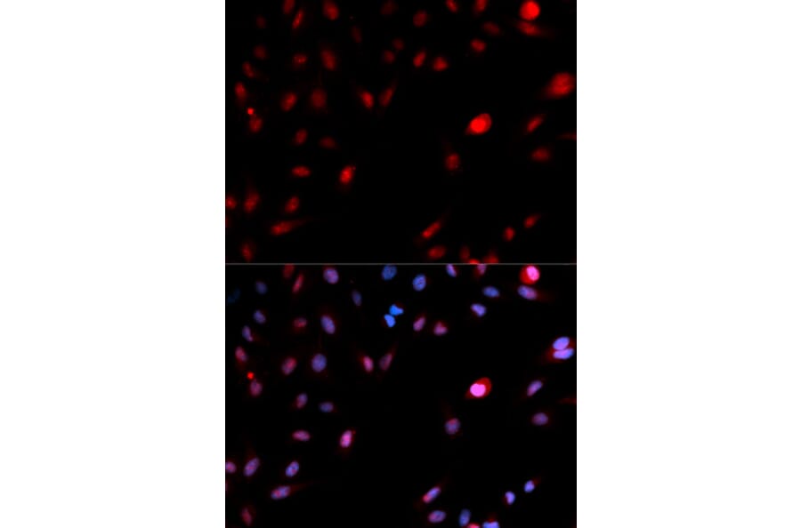Anti-Cdk1/Cdc2 (phospho-Y15) Antibody from Bioworld Technology (BS6342) - Antibodies.com