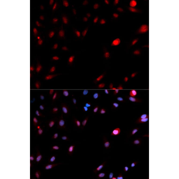 Anti-Cdk1/Cdc2 (phospho-Y15) Antibody from Bioworld Technology (BS6342) - Antibodies.com