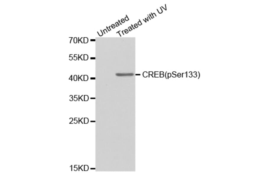 Anti-CREB (phospho-S133) Antibody from Bioworld Technology (BS6345) - Antibodies.com
