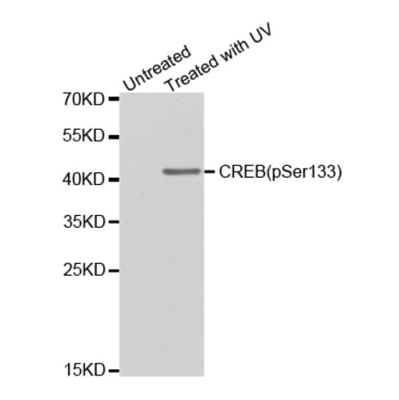 Anti-CREB (phospho-S133) Antibody from Bioworld Technology (BS6345) - Antibodies.com