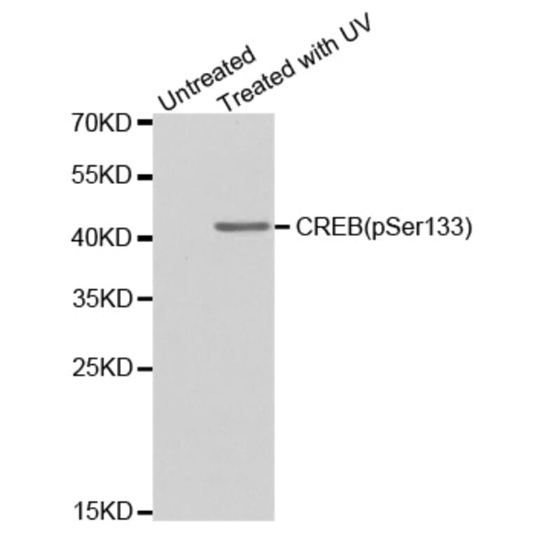 Anti-CREB (phospho-S133) Antibody from Bioworld Technology (BS6345) - Antibodies.com