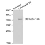 Anti-CREB (phospho-S133) Antibody from Bioworld Technology (BS6345) - Antibodies.com
